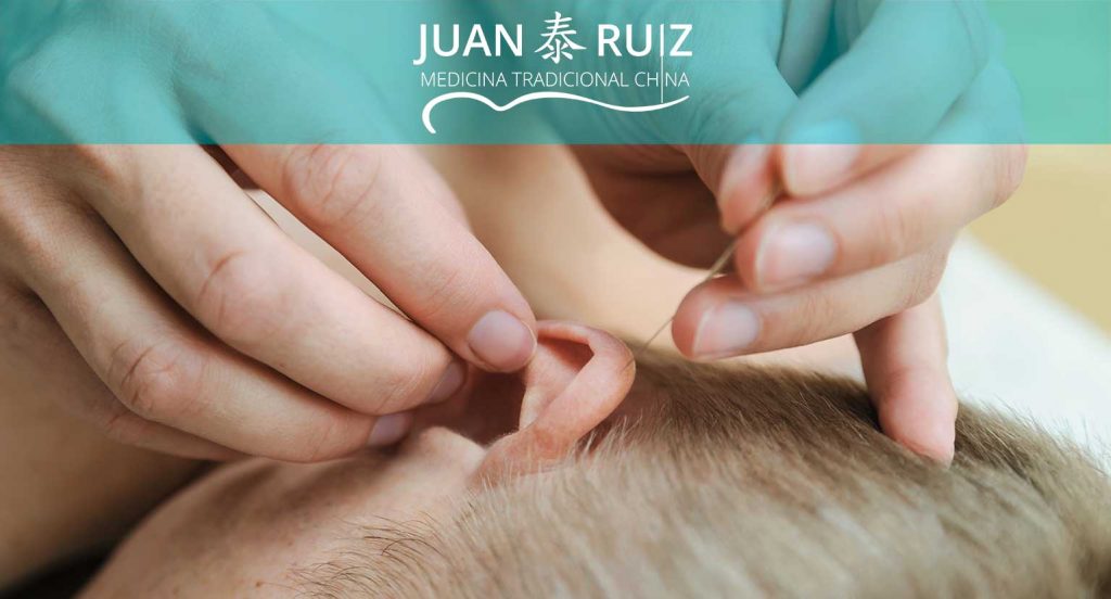 auriculoterapia o acupuntura en Granada en la consulta de medicina china en Granada